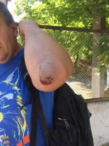 В Херсоне двое неизвестных избили журналиста