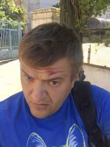 В Херсоне двое неизвестных избили журналиста