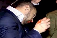 Спор между нардепами Мельничуком и Линько закончился сломанным носом. Видео